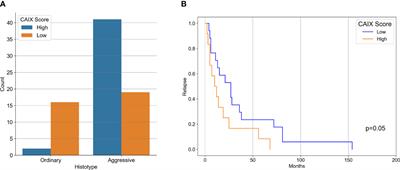 Tissue Expression of Carbonic Anhydrase IX Correlates to More Aggressive Phenotype of Basal Cell Carcinoma